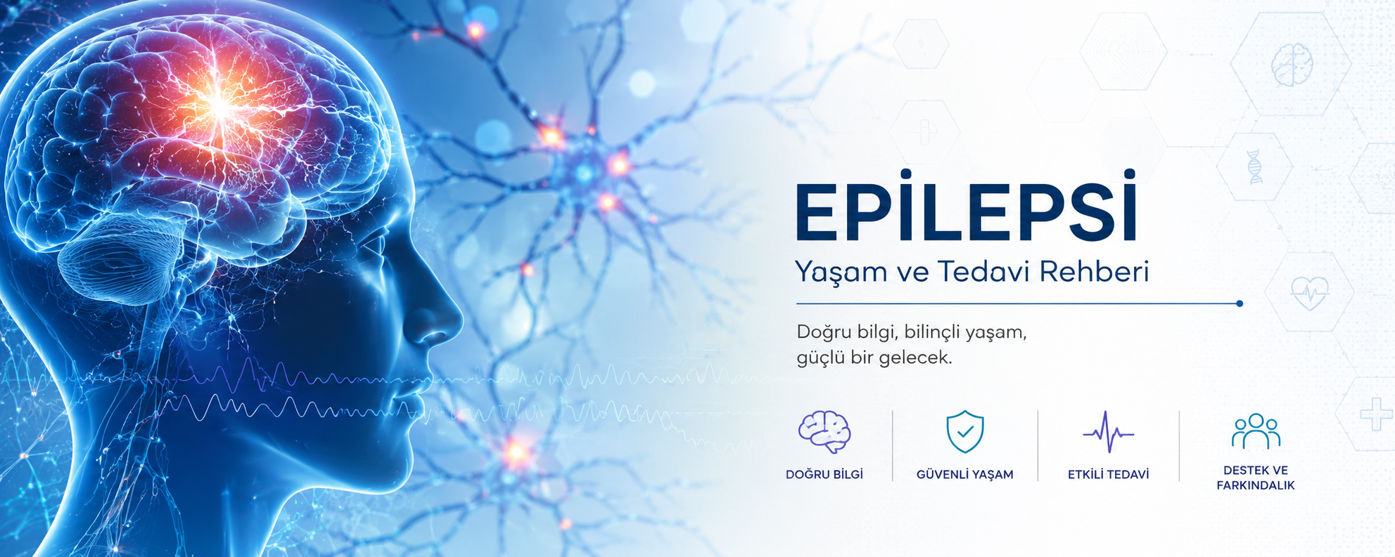 epilepsi rhberi
