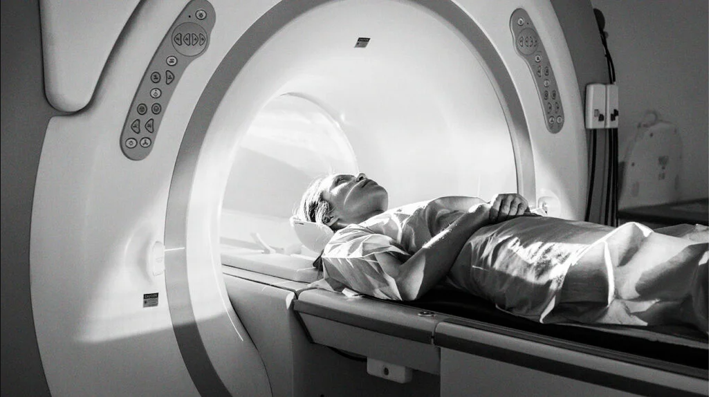 MS tanı yöntemleri